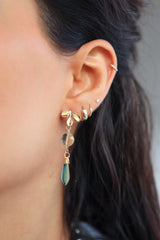Aretes Plasma